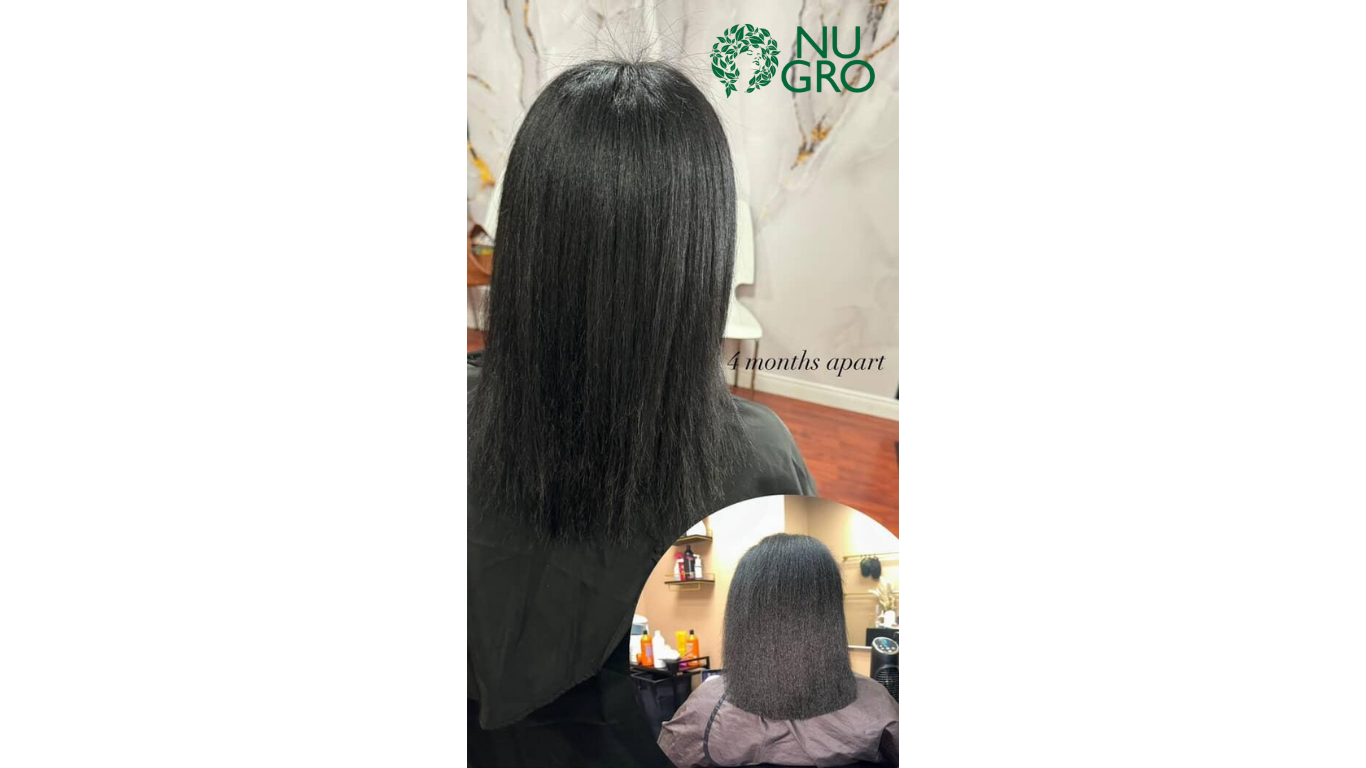 NUGRO Mega Hair-GRO System Review: Hair Growth Support
