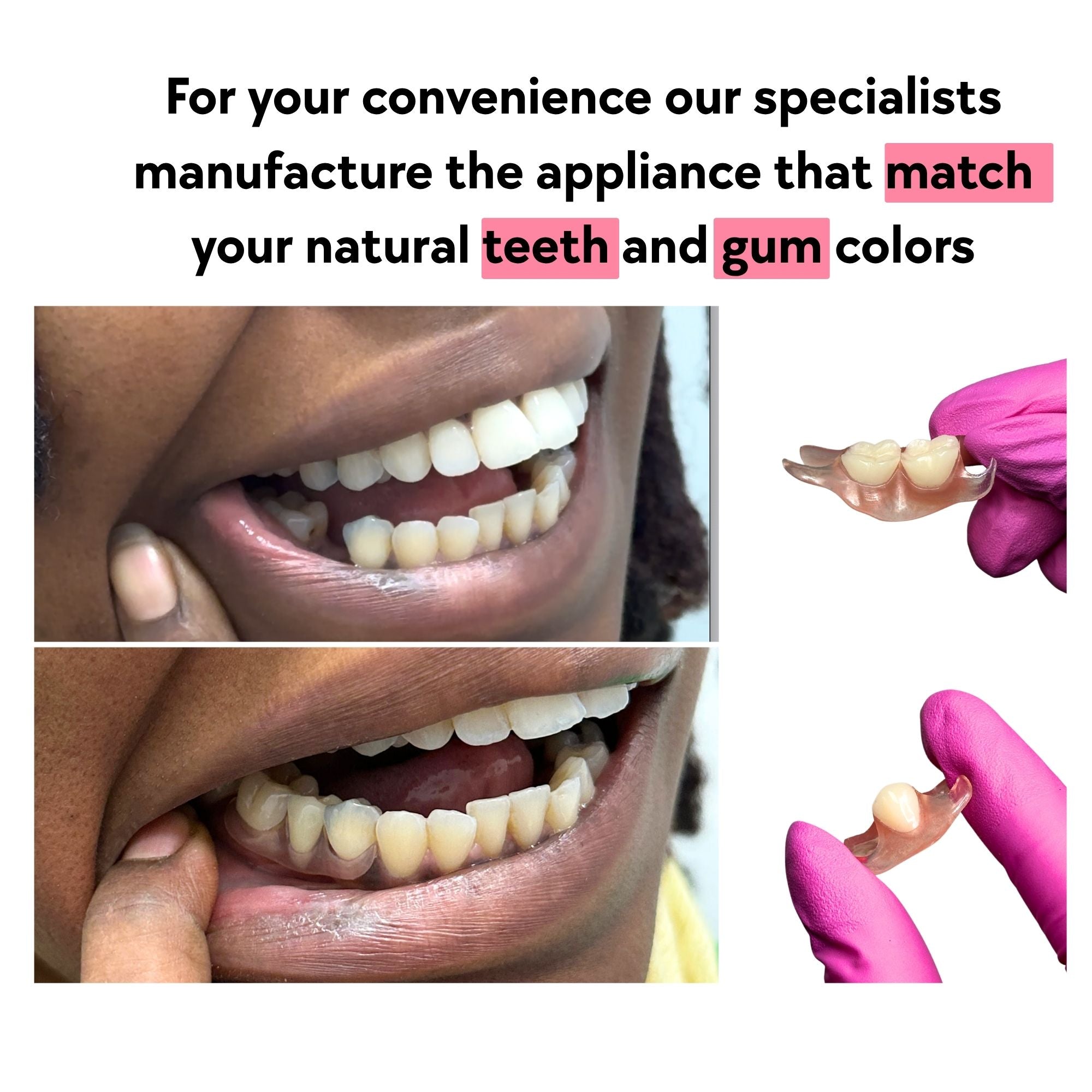 Smile Boutique NY Flexi Flipper Review: An Honest Look at the Order-Online Partial Denture