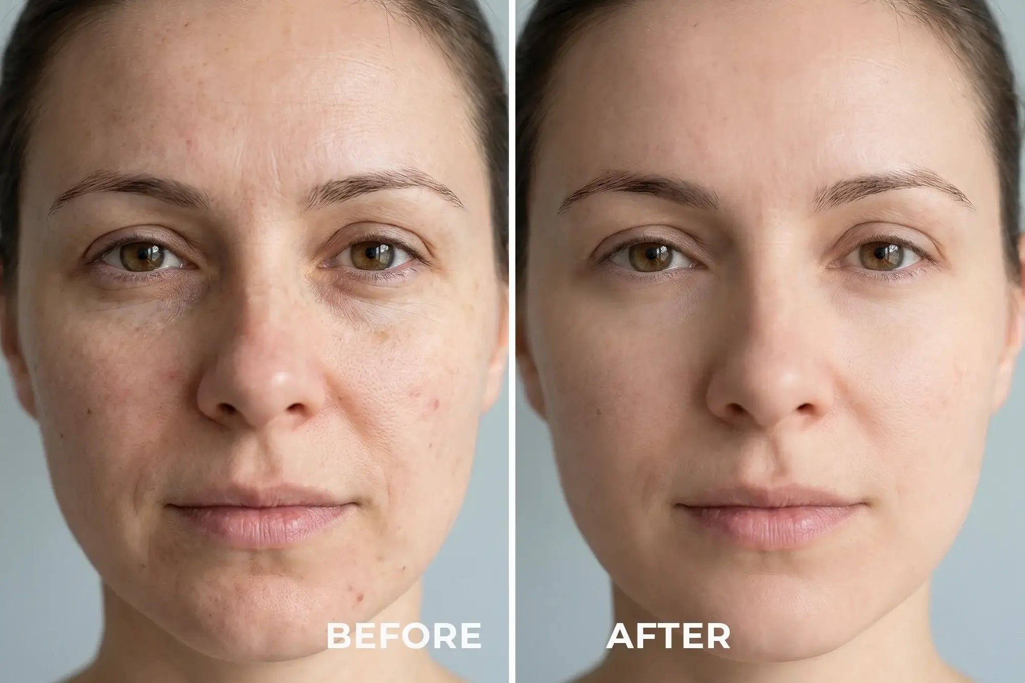 WAU LED Mask 2.0 Review: Phototherapy Skincare at Home