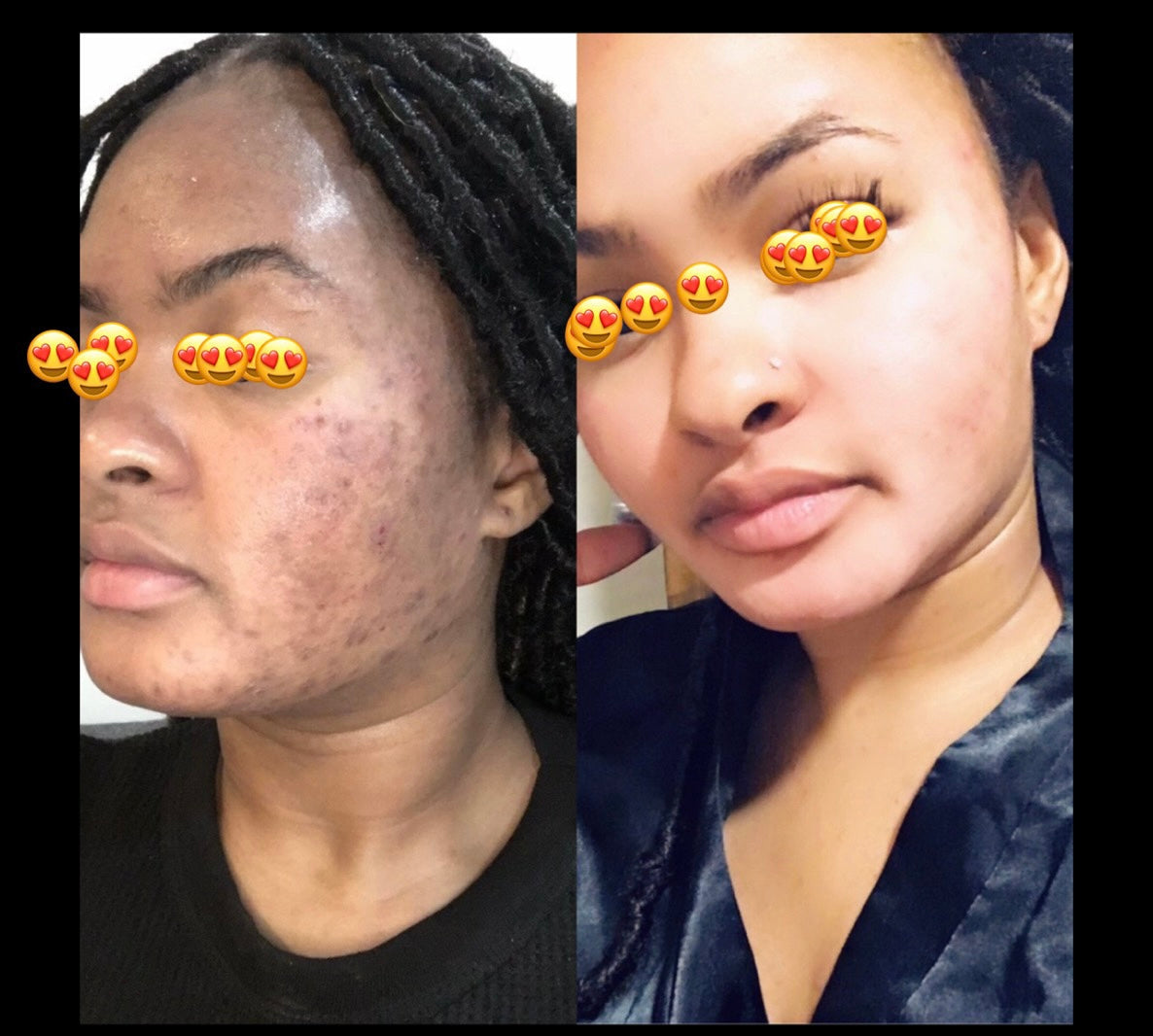 Whitenicious Fast Acting Dark Spot Eraser Review